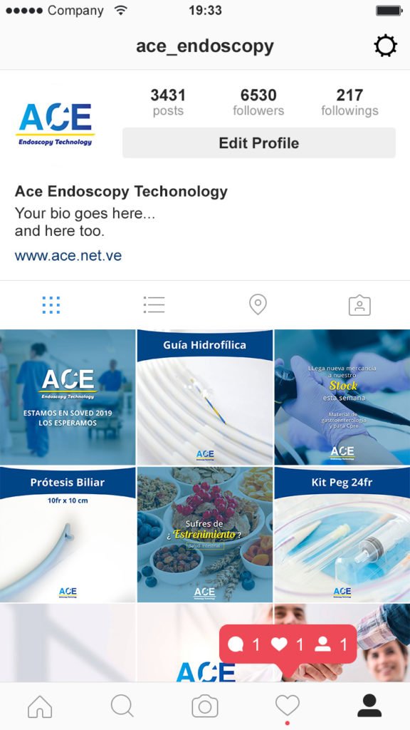 Ace Endoscopy feed